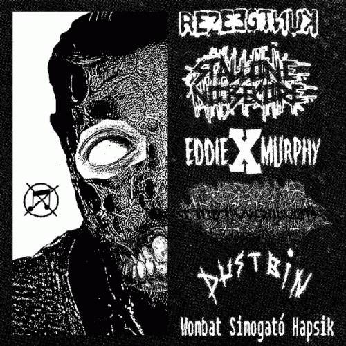 Trabecular Hepatocellular Carcinoma : 6way